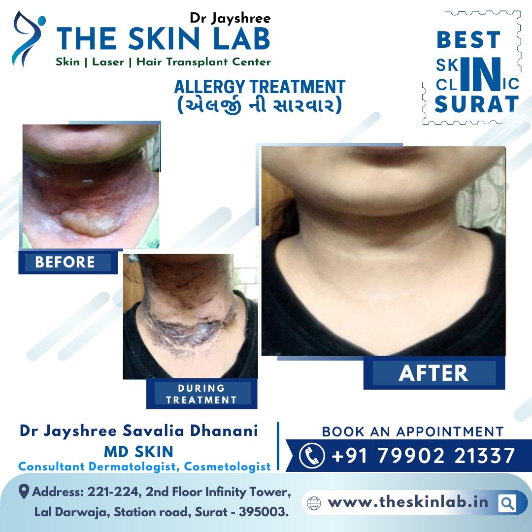 Top Skin Polishing Doctors in Bareilly - Best Skin Specialists-skin  Polishing - Book Appointment Online - Justdial
